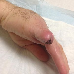 Finger/hand